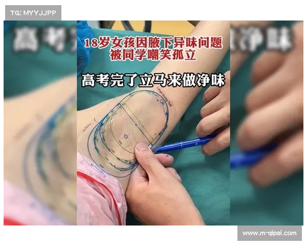 拳台医生王磊:10年处理200例创伤,最怕耳廓血肿畸形